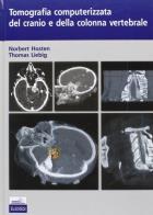 Tomografia computerizzata del cranio e della colonna vertebrale