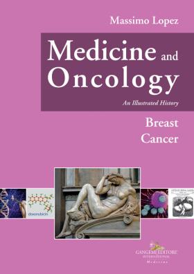 Medicine and oncology. an illustrated history. vol. 8: breast cancer